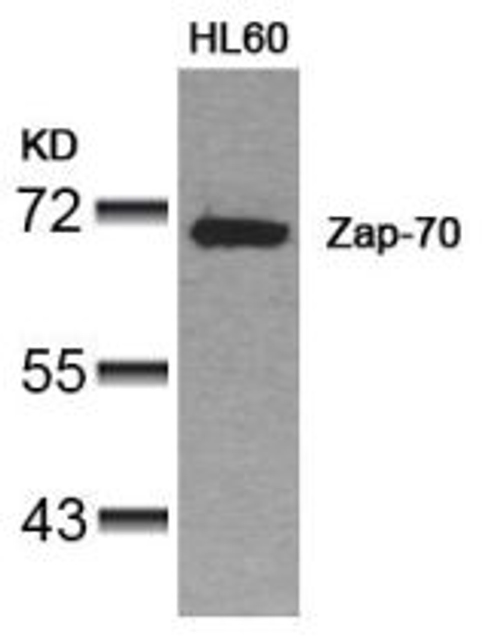 Western blot analysis of lysed extracts from HL60 cells using Zap-70 (Ab-319) .