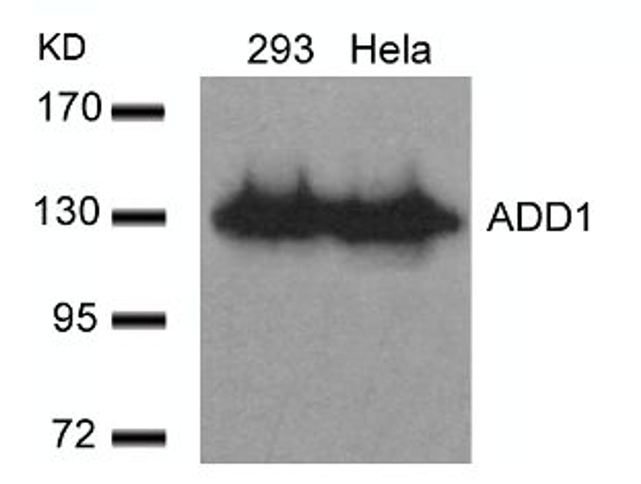 Western blot analysis of lysed extracts from 293 and HeLa cells using ADD1 (Ab-726) .
