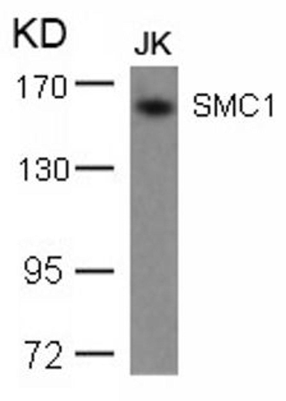 Western blot analysis of lysed extracts from JK cells using SMC1 (Ab-957) .