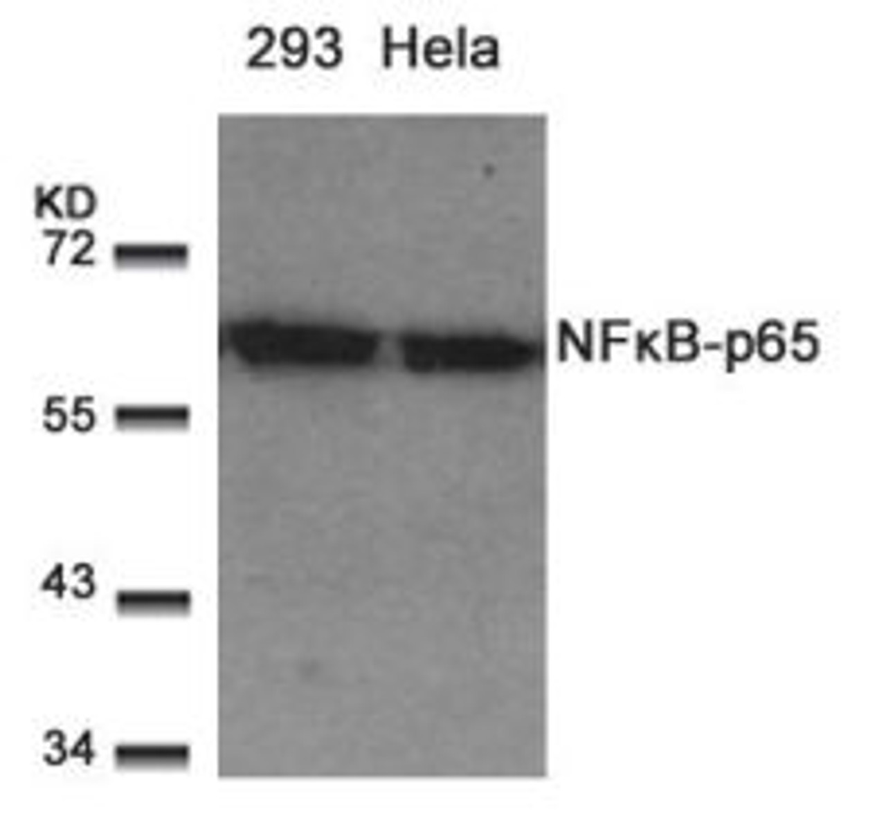 Western blot analysis of lysed extracts from 293 and HeLa cells using NF&#954;B-p65 (Ab-529) .