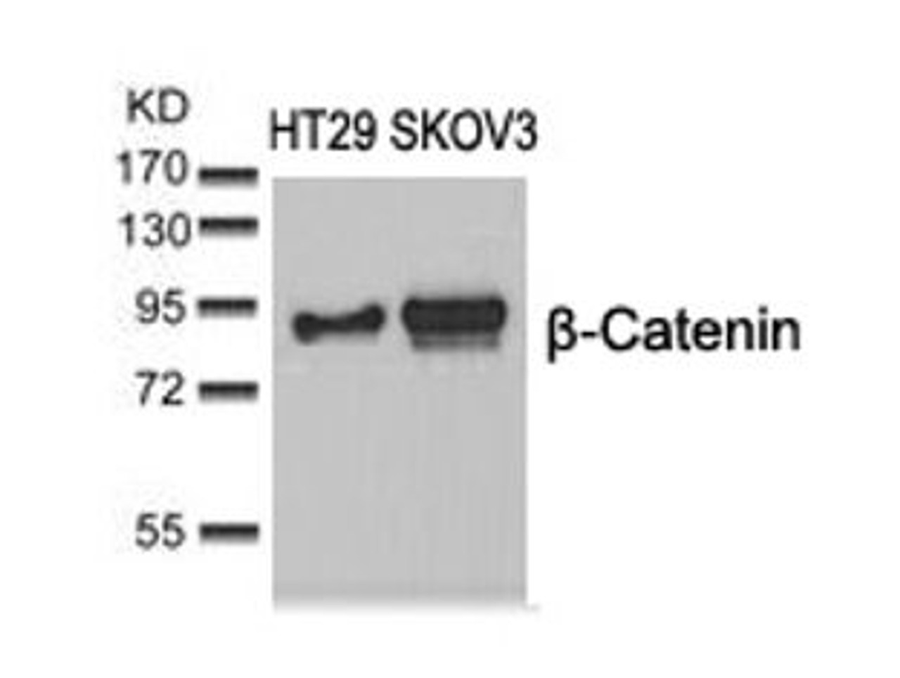 Western blot analysis of lysed extracts from HT29 and SKOV3 cells using &#946;-Catenin (Ab-37) .