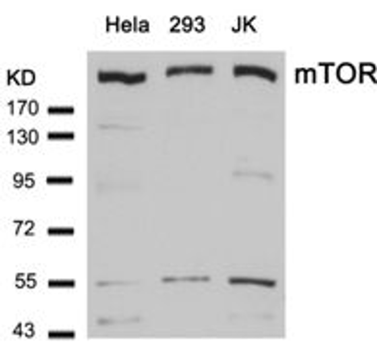 Western blot analysis of lysed extracts from HeLa, 293 and JK cells using mTOR (Ab-2448) .