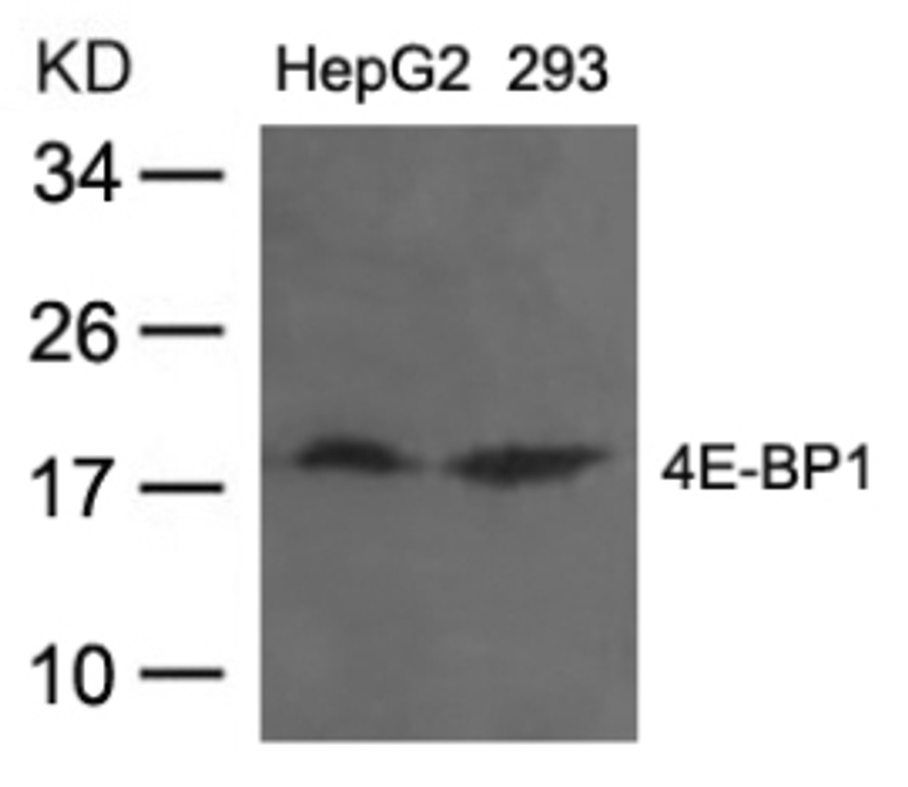 Western blot analysis of lysed extracts from HepG2 and 293 cells using 4E-BP1 (Ab-36) .