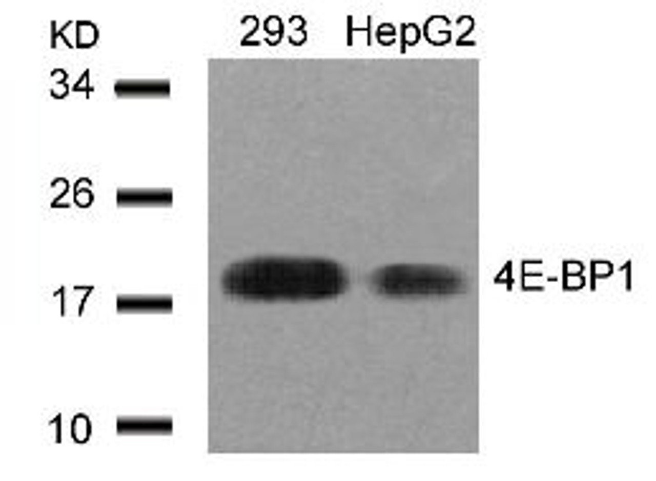 Western blot analysis of lysed extracts from 293 and HepG2 cells using 4E-BP1 (Ab-45) .