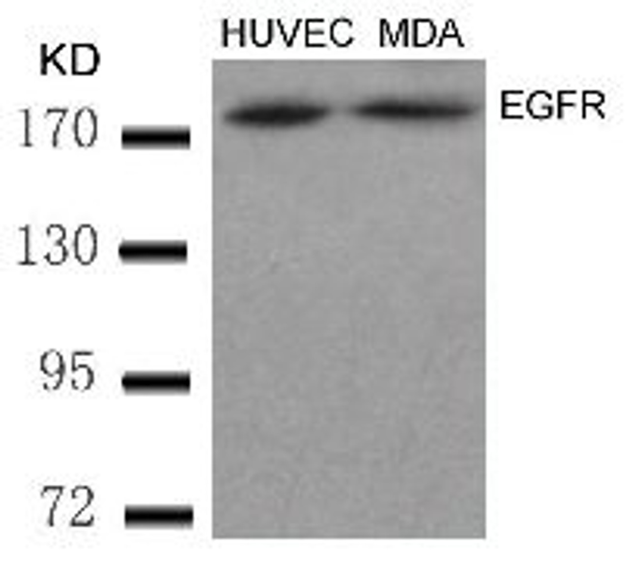 Western blot analysis of lysed extracts from HUVEC and MDA cells using EGFR (Ab-869) .