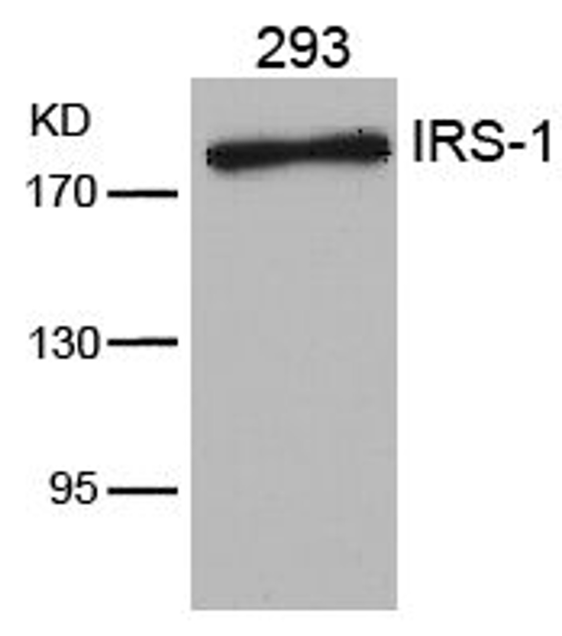 Western blot analysis of lysed extracts from 293 cells using IRS-1 (Ab-636) .