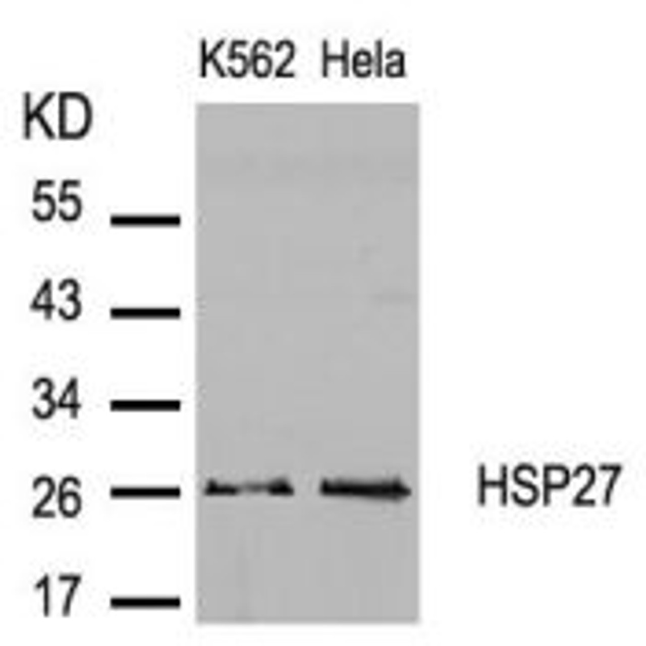 Western blot analysis of lysed extracts from K562 and HeLa cells using HSP27 (Ab-82) .