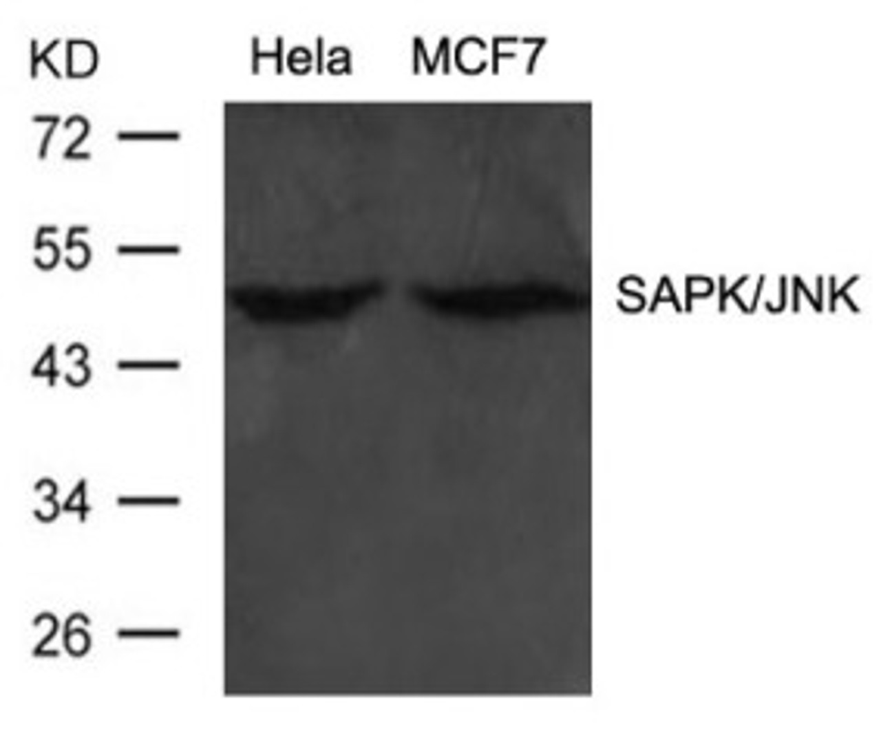 Western blot analysis of lysed extracts from HeLa and MCF cells using SAPK/JNK (Ab-183) .