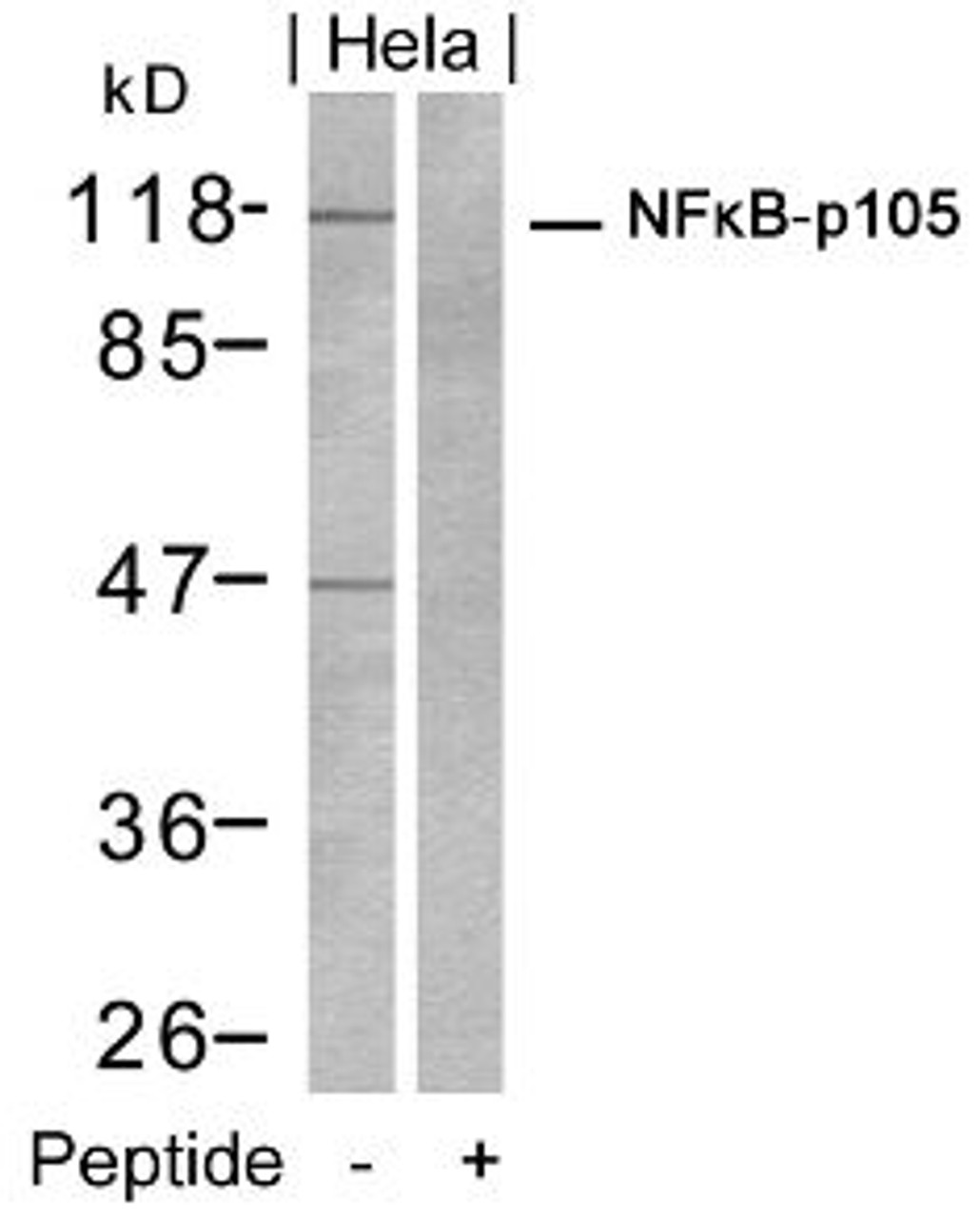 Western blot analysis of lysed extracts from HeLa cells using NF&#954;B-p105/p50 (Ab-932) .