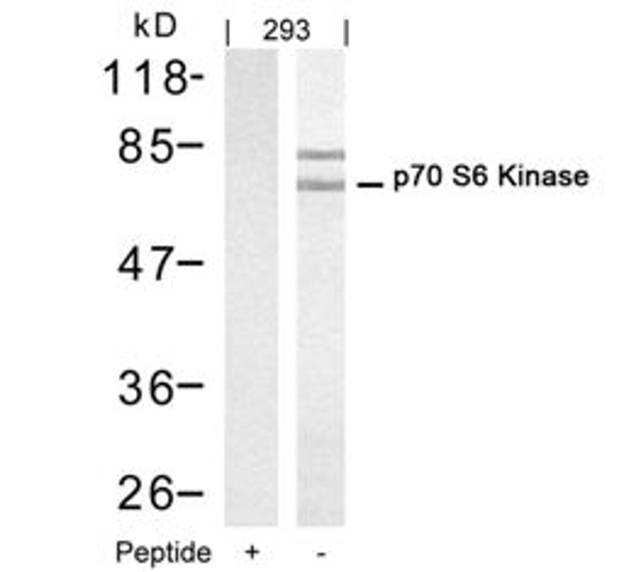 Western blot analysis of lysed extracts from 293 cells using p70 S6 Kinase (Ab-421) .