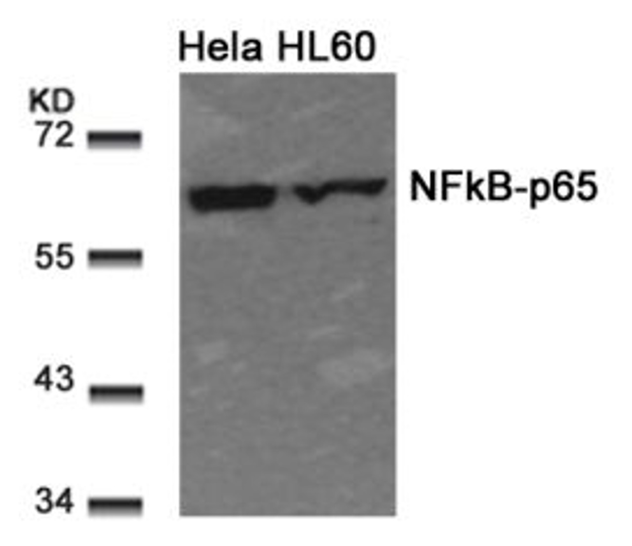 Western blot analysis of lysed extracts from HeLa and HL60 cells using NF&#954;B-p65 (Ab-311) .
