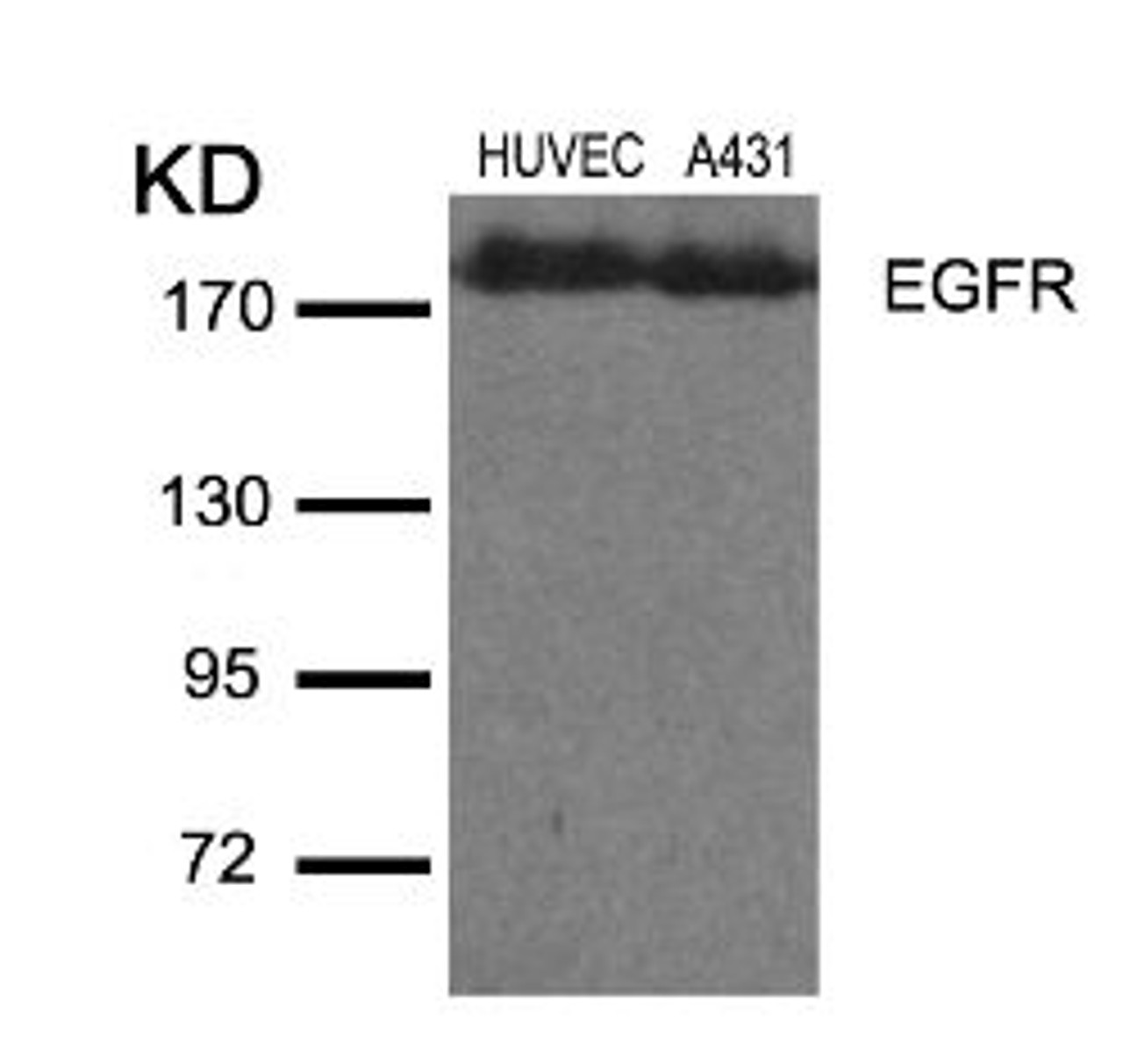 Western blot analysis of lysed extracts from HUVEC and A431 cells using EGFR (Ab-1110) .