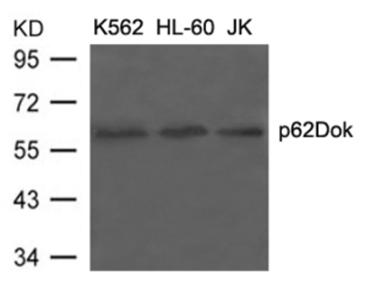 Western blot analysis of lysed extracts from K562, HL-60 and JK cells using p62Dok (Ab-398) .