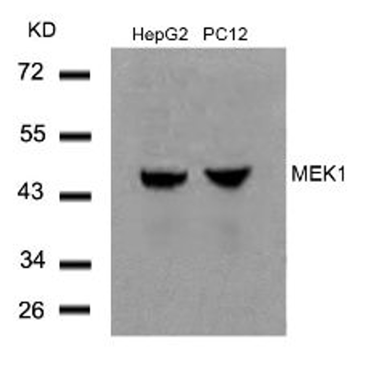 Western blot analysis of lysed extracts from HepG2 and PC12 cells using MEK1 (Ab-291) .