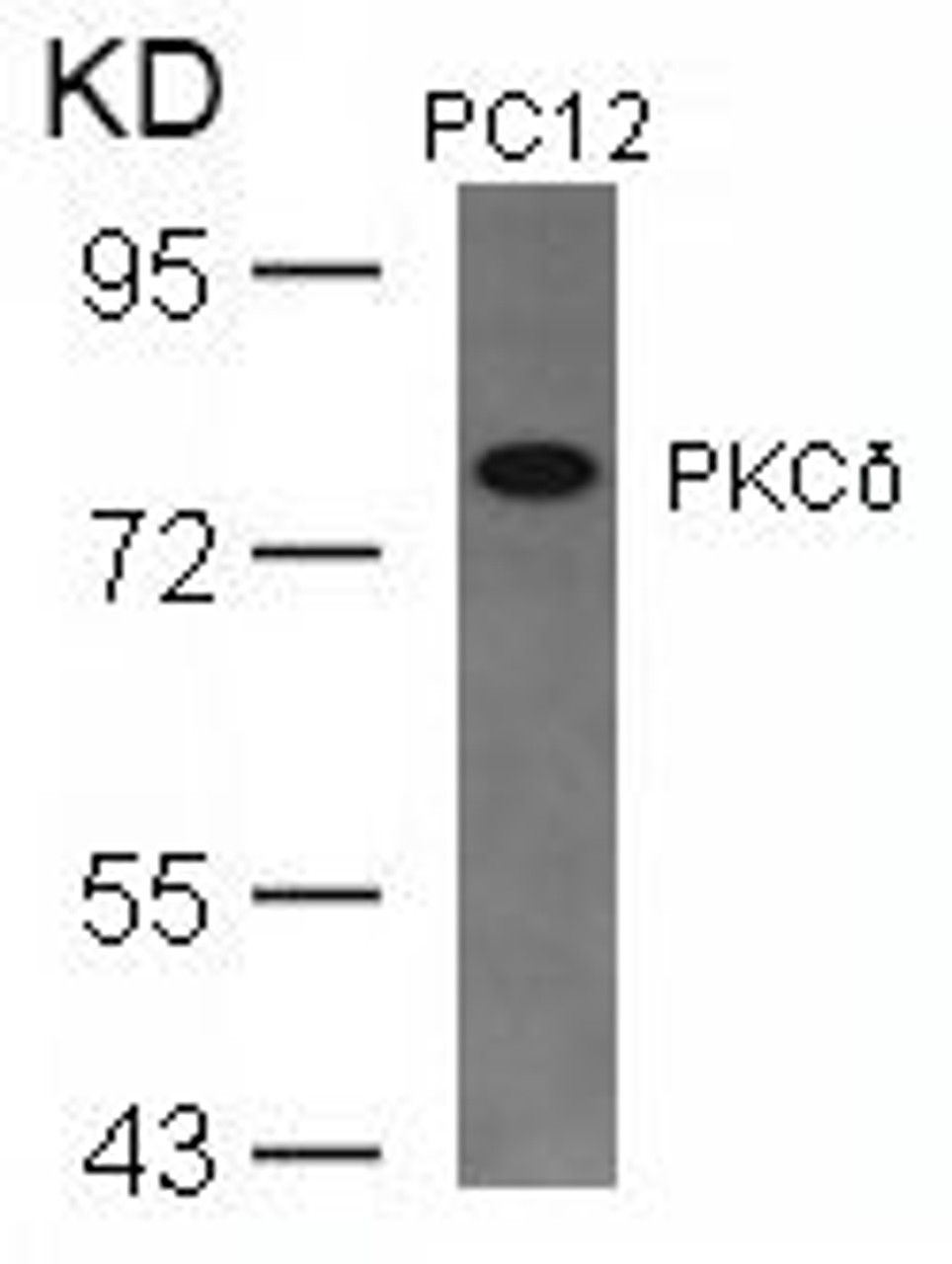 Western blot analysis of lysed extracts from PC12 cells using PKC&#948; (Ab-645) .