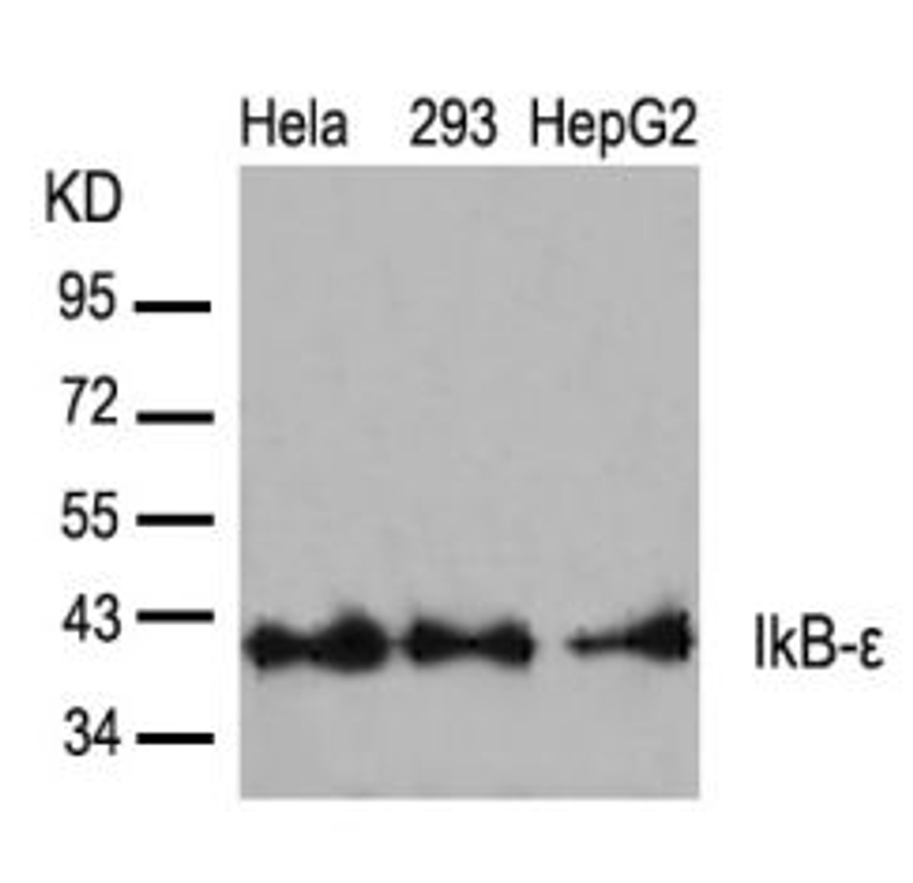 Western blot analysis of lysed extracts from HeLa, 293 and HepG2 cells using IkB-&#949; (Ab-22) .