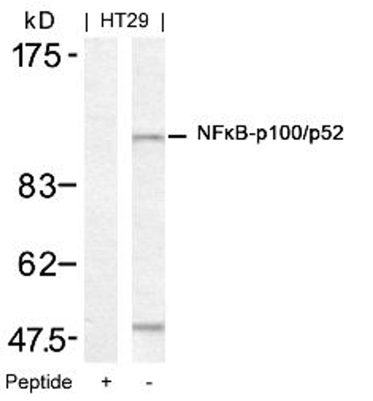 Western blot analysis of lysed extracts from HT29 cells using NF&#954;B-p100/p52 (Ab-872) .