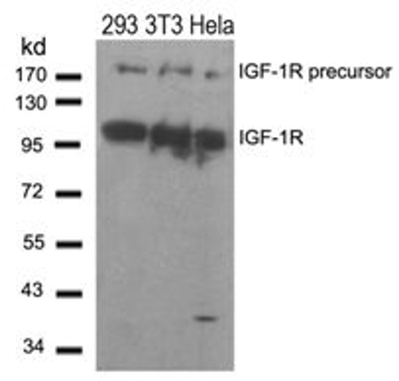 Western blot analysis of lysed extracts from 293, 3T3 and HeLa cells using IGF-1R (Ab-1280) .