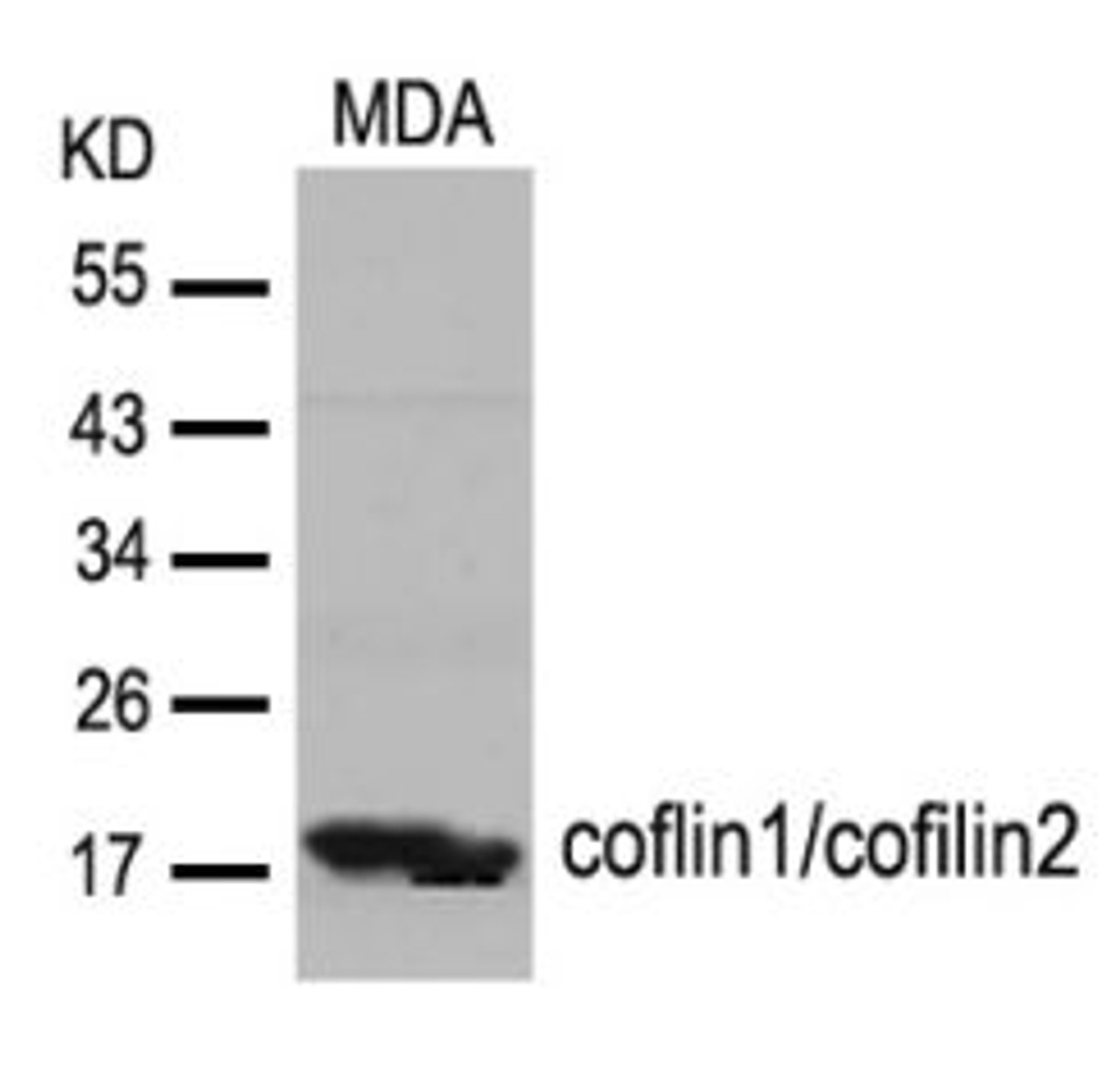 Western blot analysis of lysed extracts from MDA cells using coflin1/cofilin2 (Ab-88) .