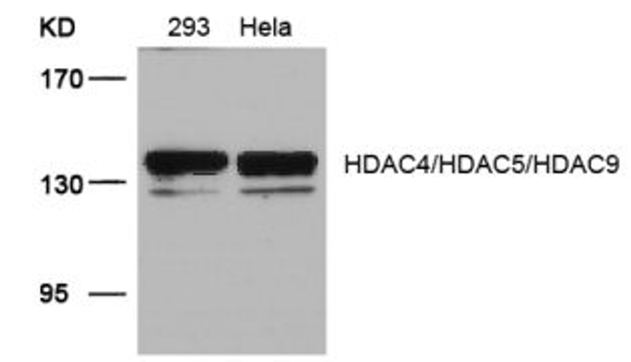 Western blot analysis of lysed extracts from 293 and HeLa cells using HDAC4/HDAC5/HDAC9 (Ab-246/259/220) .