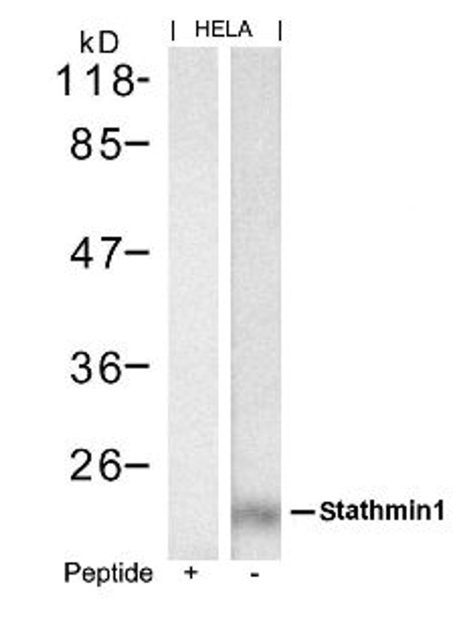 Western blot analysis of lysed extracts from HeLa cells using stathmin1 (Ab-62) .
