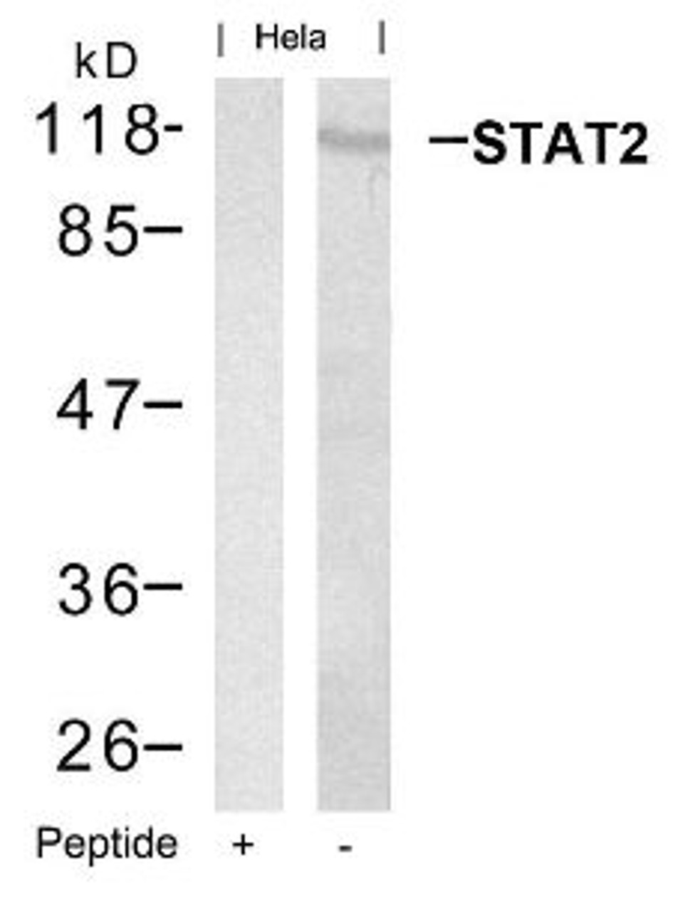 Western blot analysis of lysed extracts from HeLa cells using STAT2 (Ab-690) .
