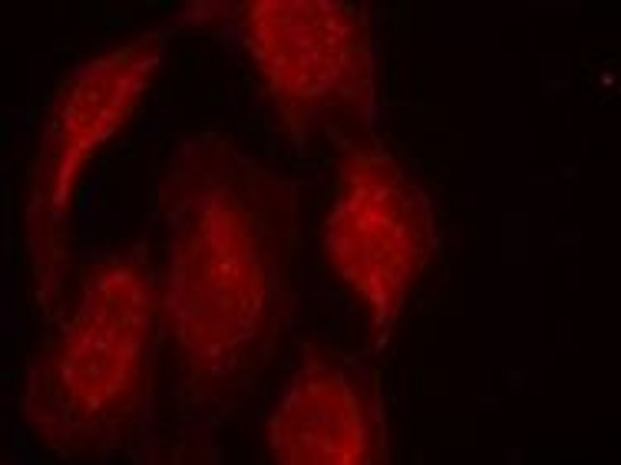 Immunofluorescence staining of methanol-fixed HeLa cells using CDK6 (Ab-13) .