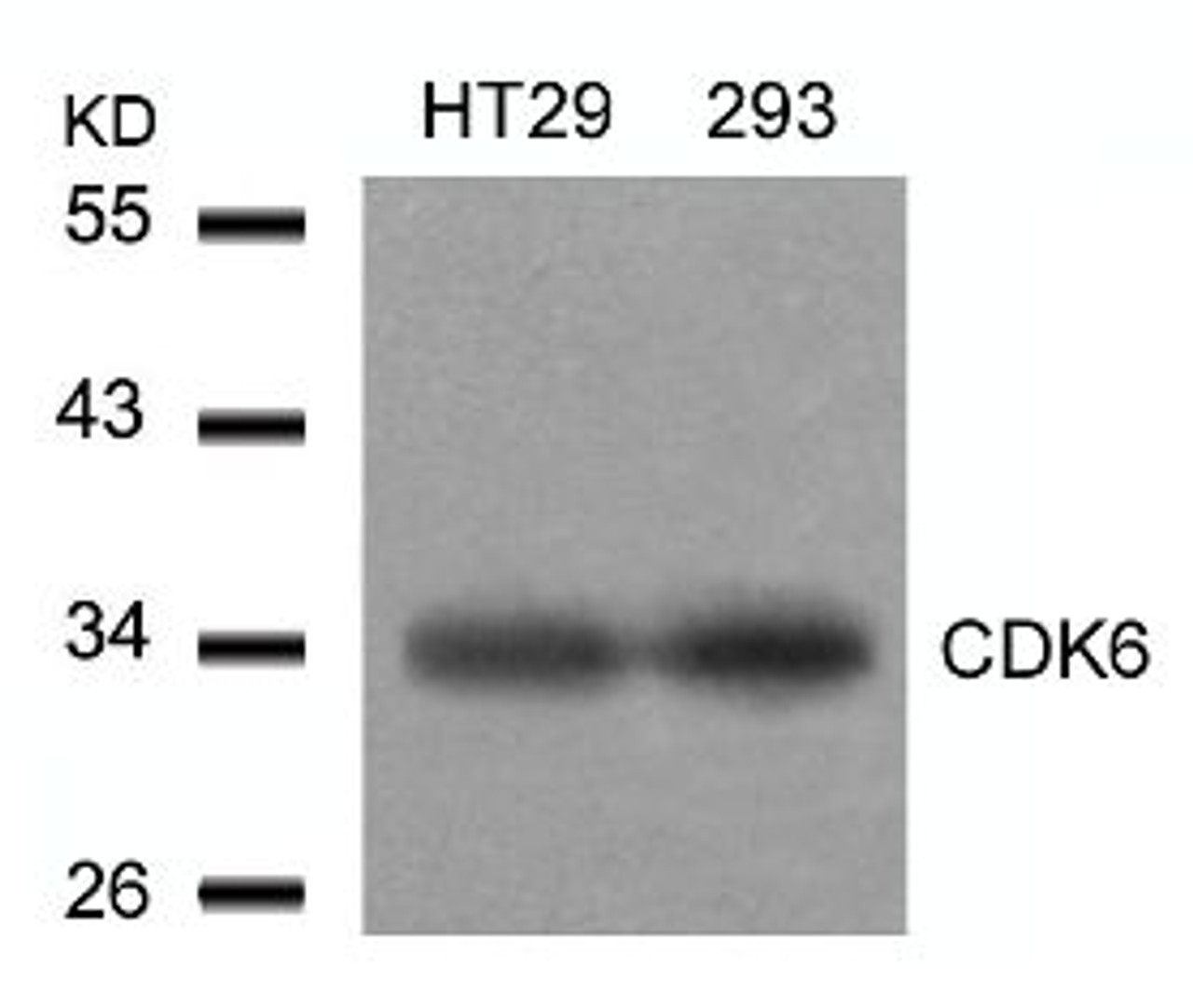 Western blot analysis of lysed extracts from HT29 and293 cells using CDK6 (Ab-24) .