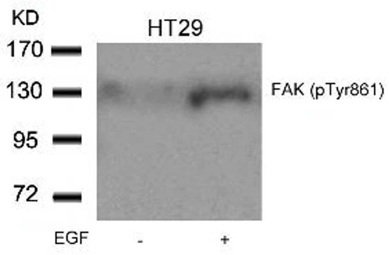 Western blot analysis of lysed extracts from HT29 cells untreated or treated with EGF using FAK (Phospho-Tyr861) .