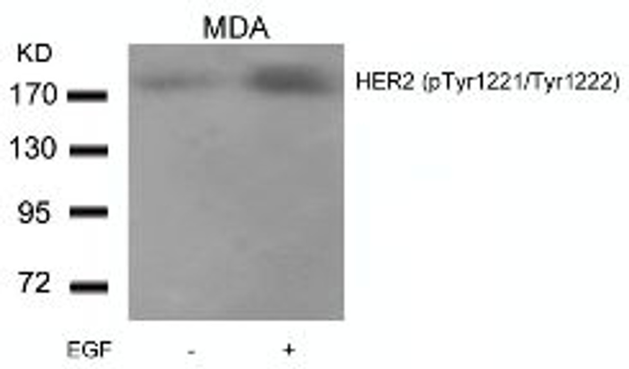 Western blot analysis of lysed extracts from MDA cells untreated or treated with EGF using HER2 (Phospho-Tyr1221/Tyr1222) .