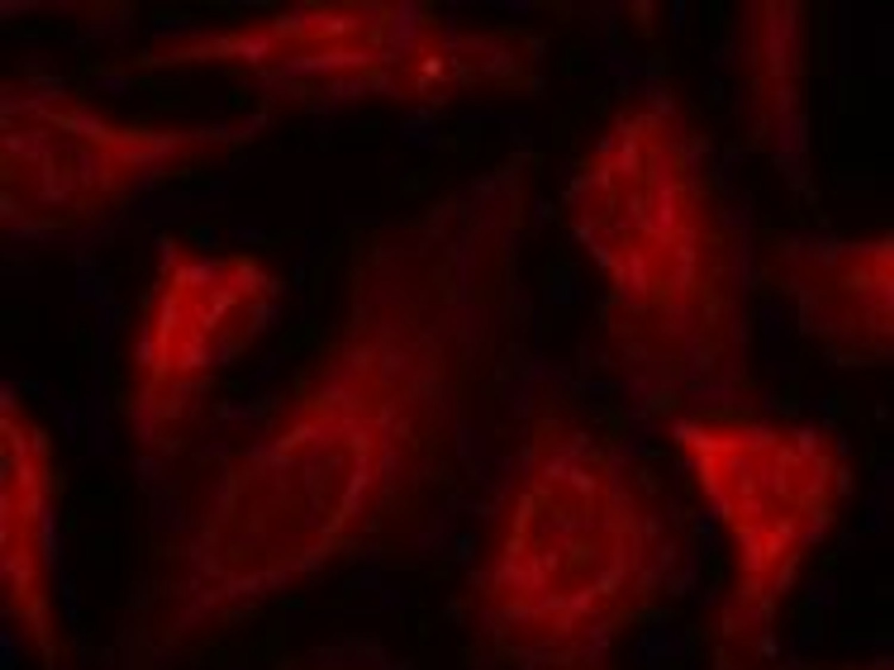 Immunofluorescence staining of methanol-fixed HeLa cells using p53 (Phospho-Ser33) .
