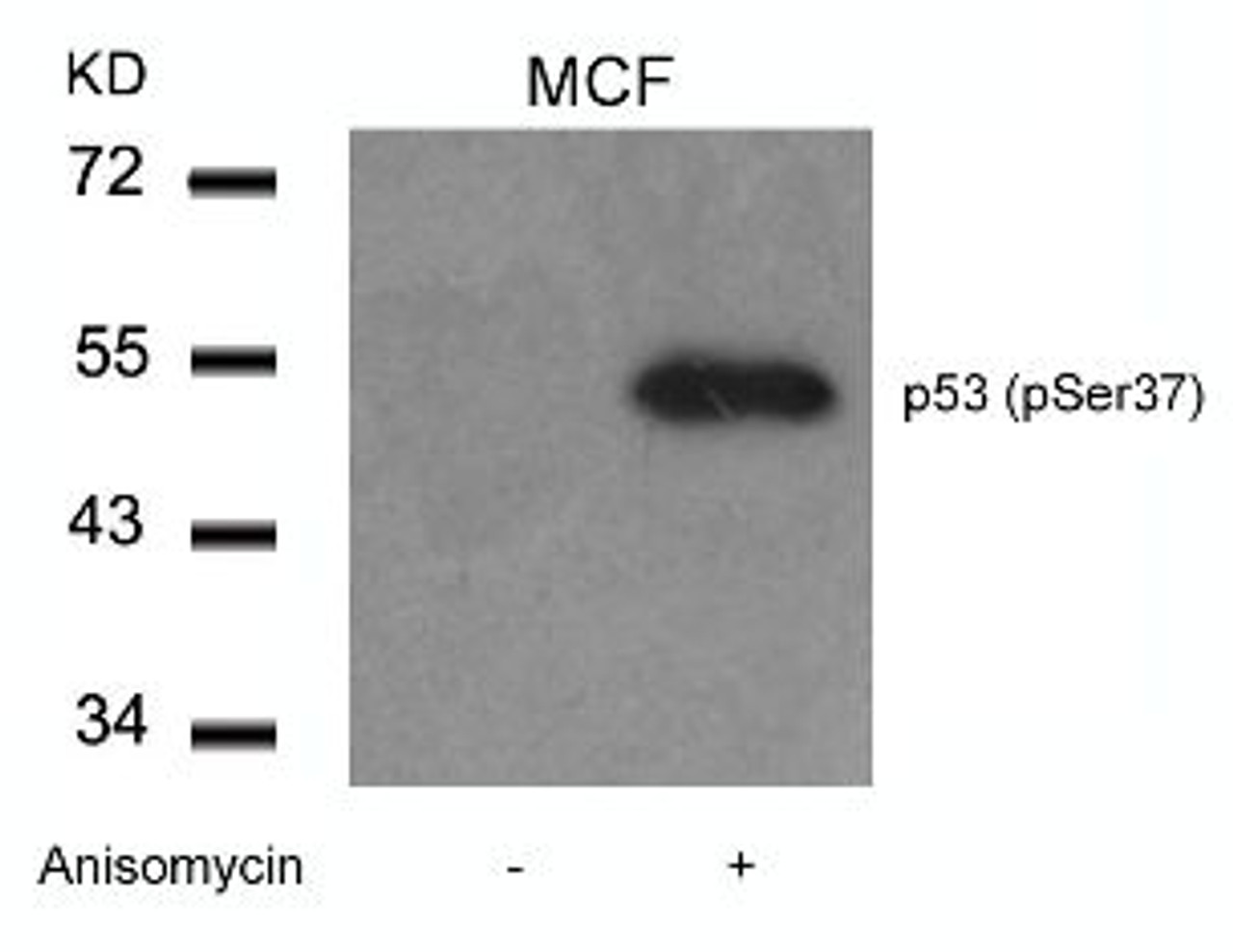Western blot analysis of lysed extracts from MCF cells untreated or treated with Anisomycin using p53 (Phospho-Ser37) .