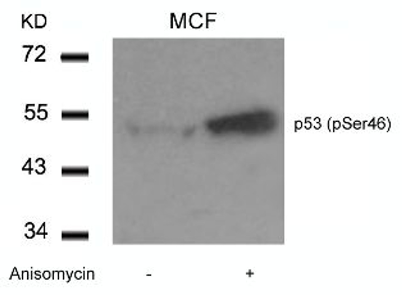 Western blot analysis of lysed extracts from MCF cells untreated or treated with Anisomycin using p53 (Phospho-Ser46) .
