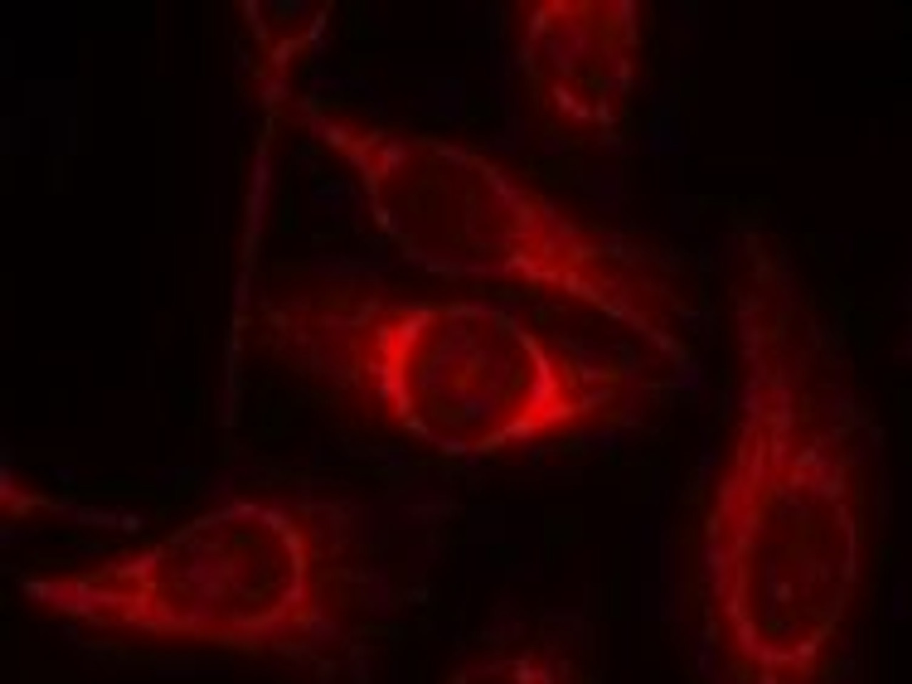 Immunofluorescence staining of methanol-fixed HeLa cells using p53 (Phospho-Ser46) .