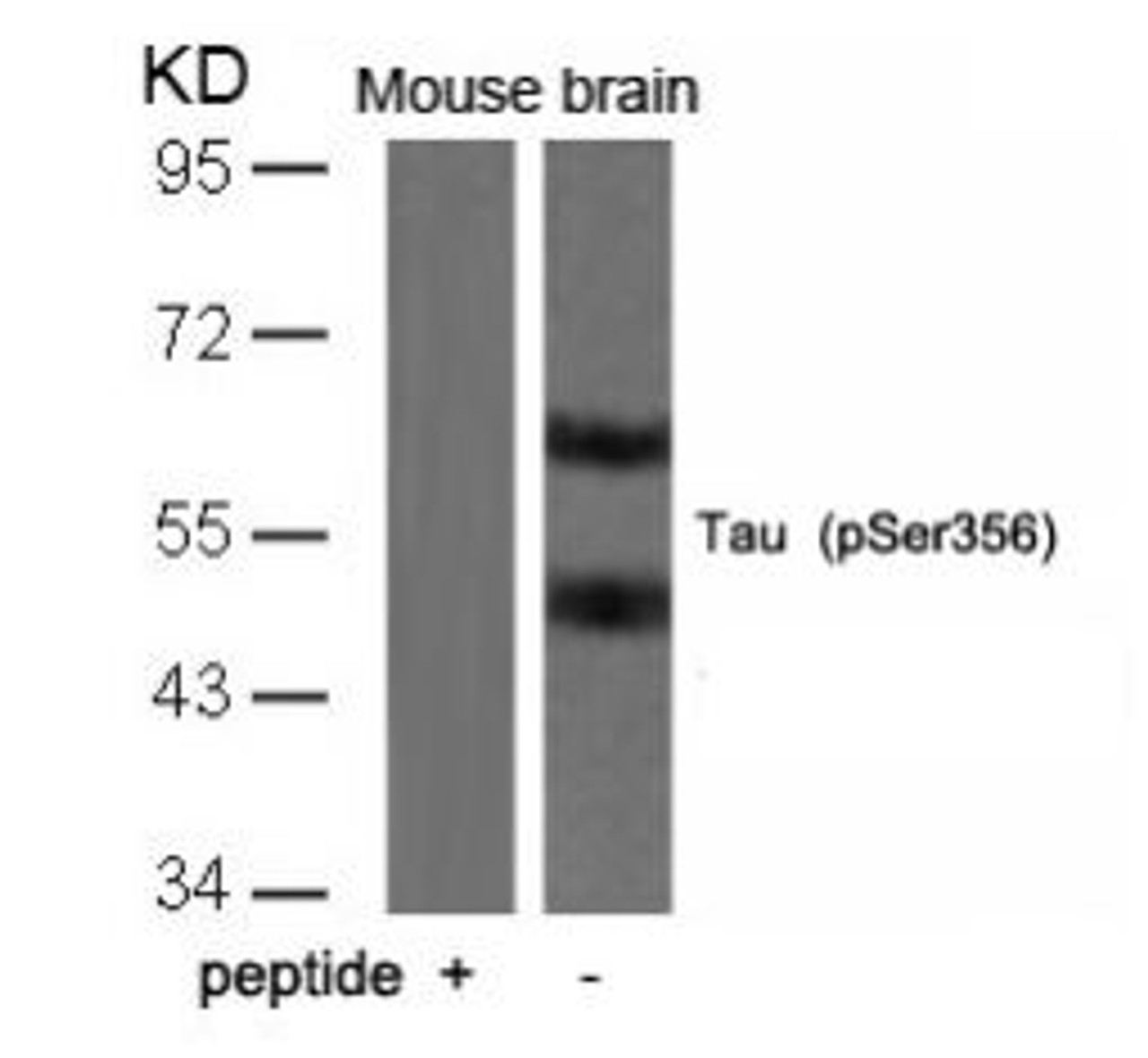 Western blot analysis of lysed extracts from mouse brain tissue using Tau (Phospho-Ser356) .
