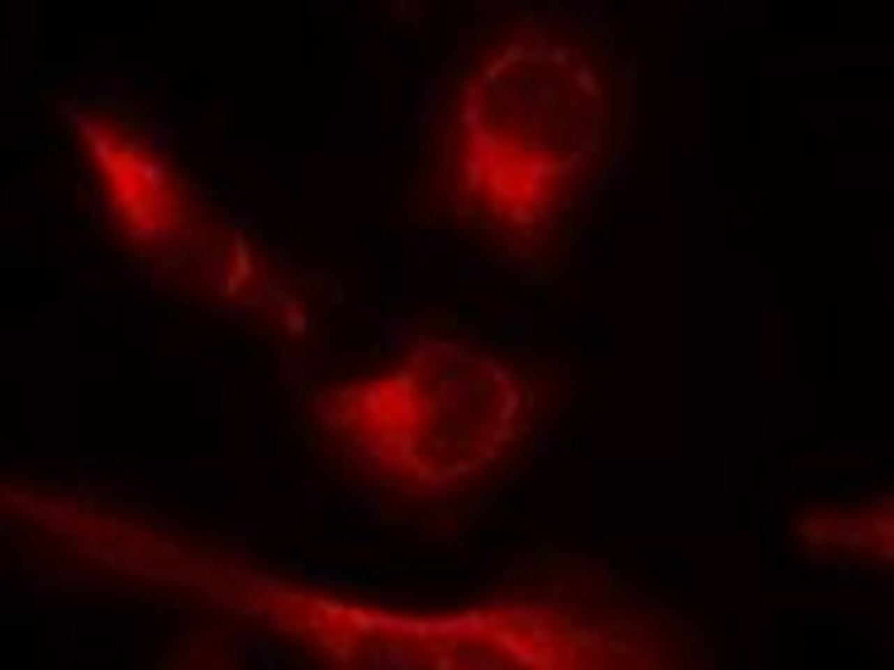 Immunofluorescence staining of methanol-fixed HeLa cells using Tau (Phospho-Ser356) .