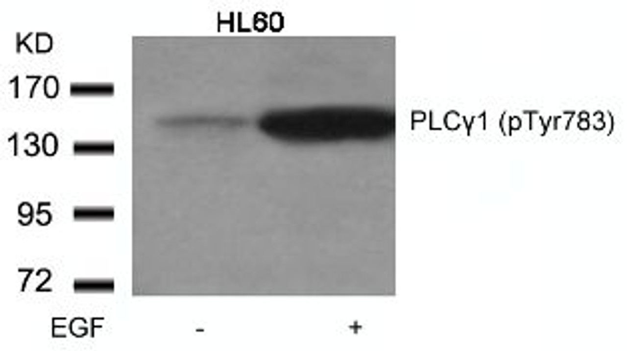 Western blot analysis of lysed extracts from HL60 cells untreated or treated with EGF using PLC&#947;1 (Phospho-Tyr783) .