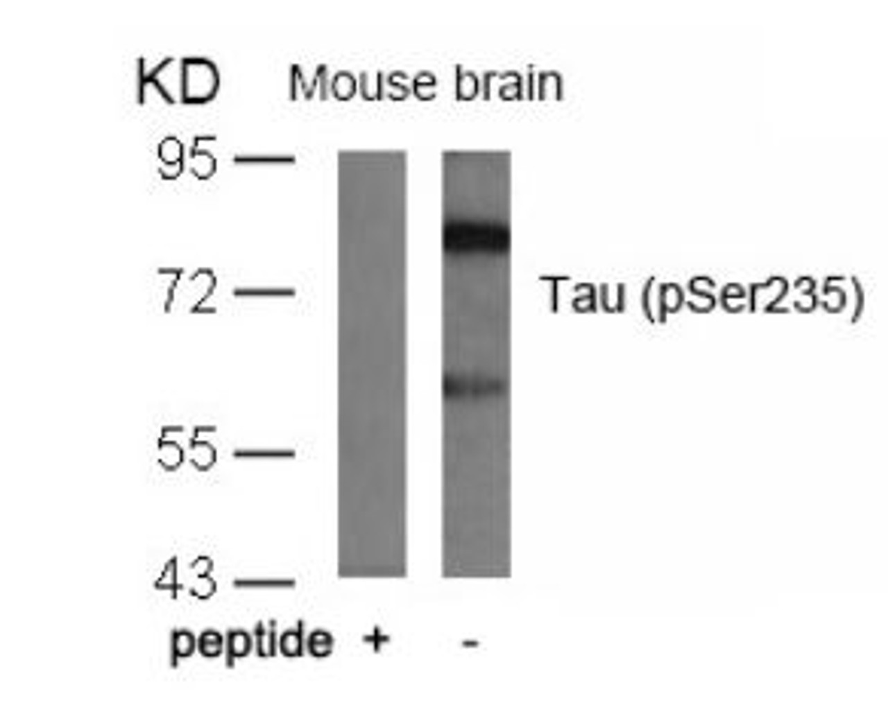 Western blot analysis of lysed extracts from mouse brain tissue using Tau (Phospho-Ser235) .