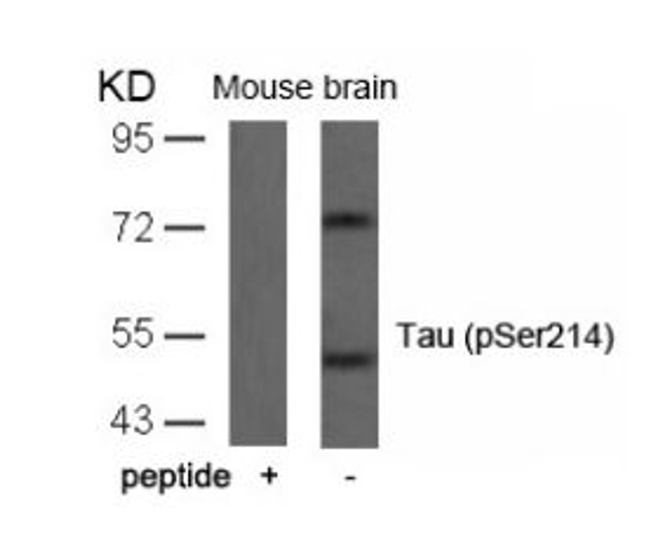 Western blot analysis of lysed extracts from mouse brain tissue using Tau (Phospho-Ser214) .