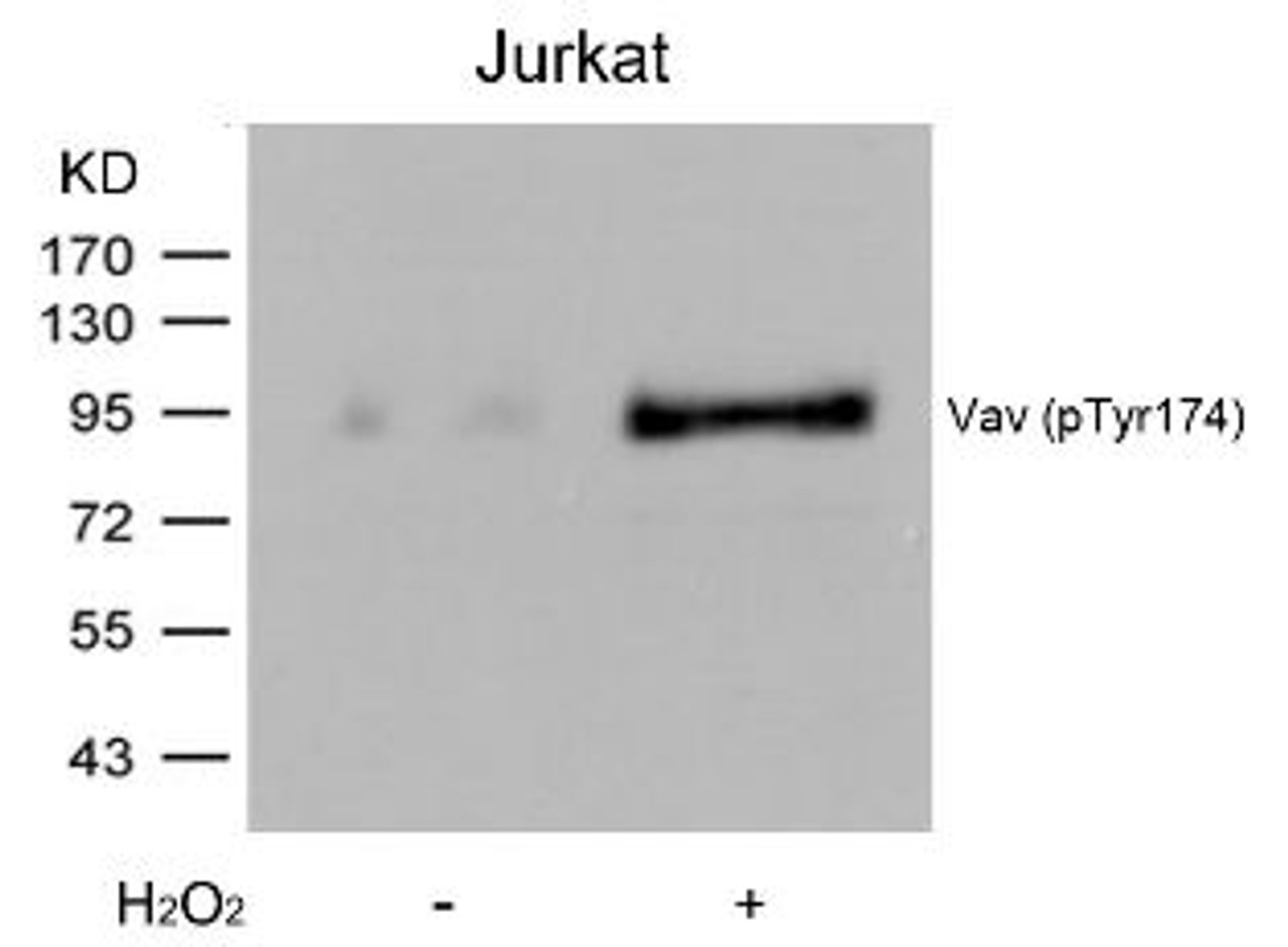 Western blot analysis of lysed extracts from Jurkat cells untreated or treated with H2O2 using Vav (Phospho-Tyr174) .
