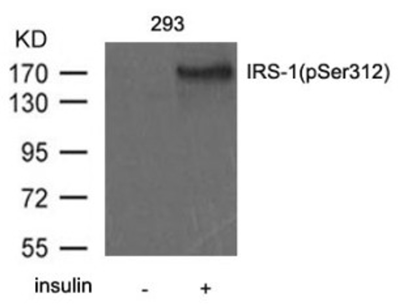 Western blot analysis of extract from 293 cells untreated or treated with insulin using IRS-1 (Phospho-Ser312) .