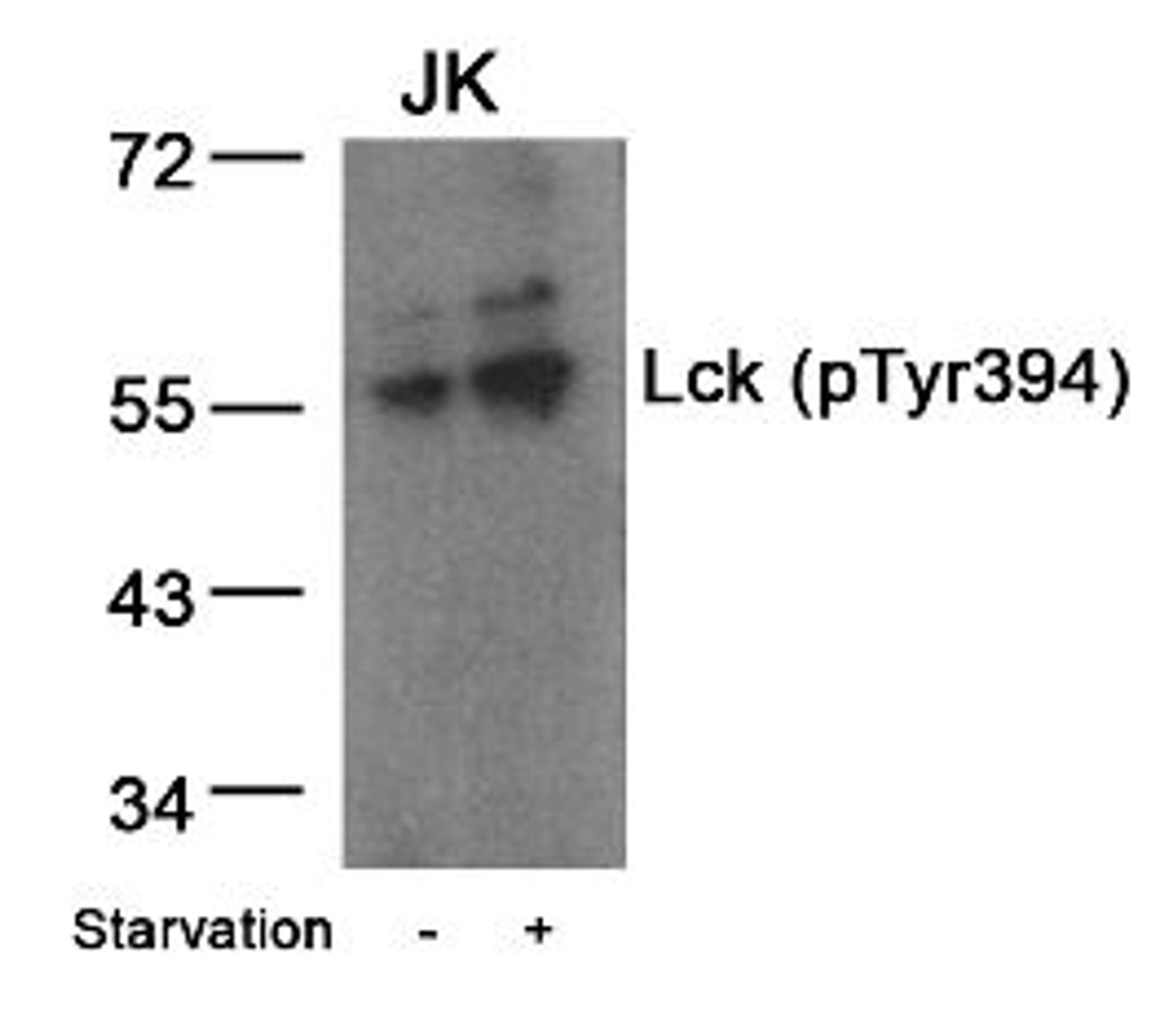 Western blot analysis of lysed extracts from JK cells untreated or treated with starvation using Lck (Phospho-Tyr394) .