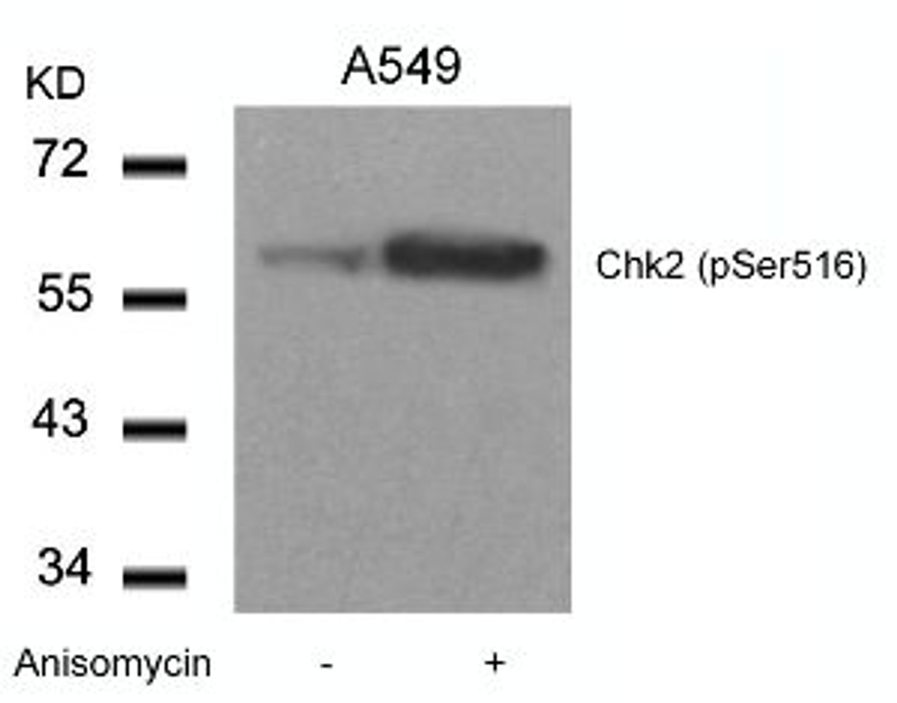 Western blot analysis of lysed extracts from A549 cells untreated or treated with Anisomycin using Chk2 (Phospho-Ser516) .