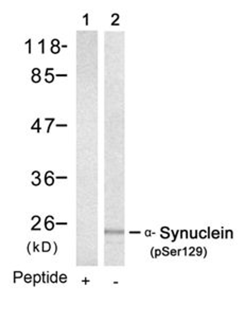 Western blot analysis of lysed extracts from mouse brain tissue using &#945;-Synuclein (Phospho-Ser129) .