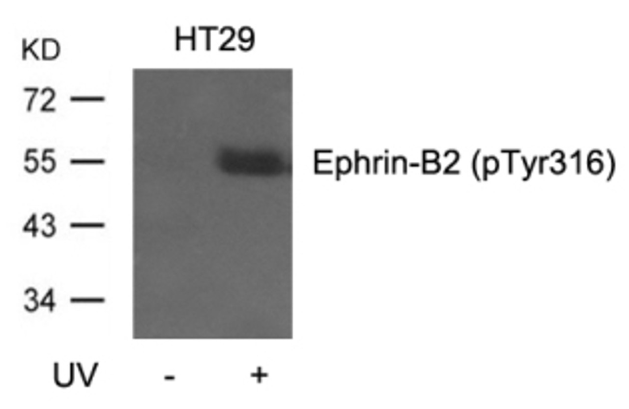 Western blot analysis of lysed extracts from HT29 cells, untreated or treated with UV using Ephrin-B2 (Phospho-Tyr316) .