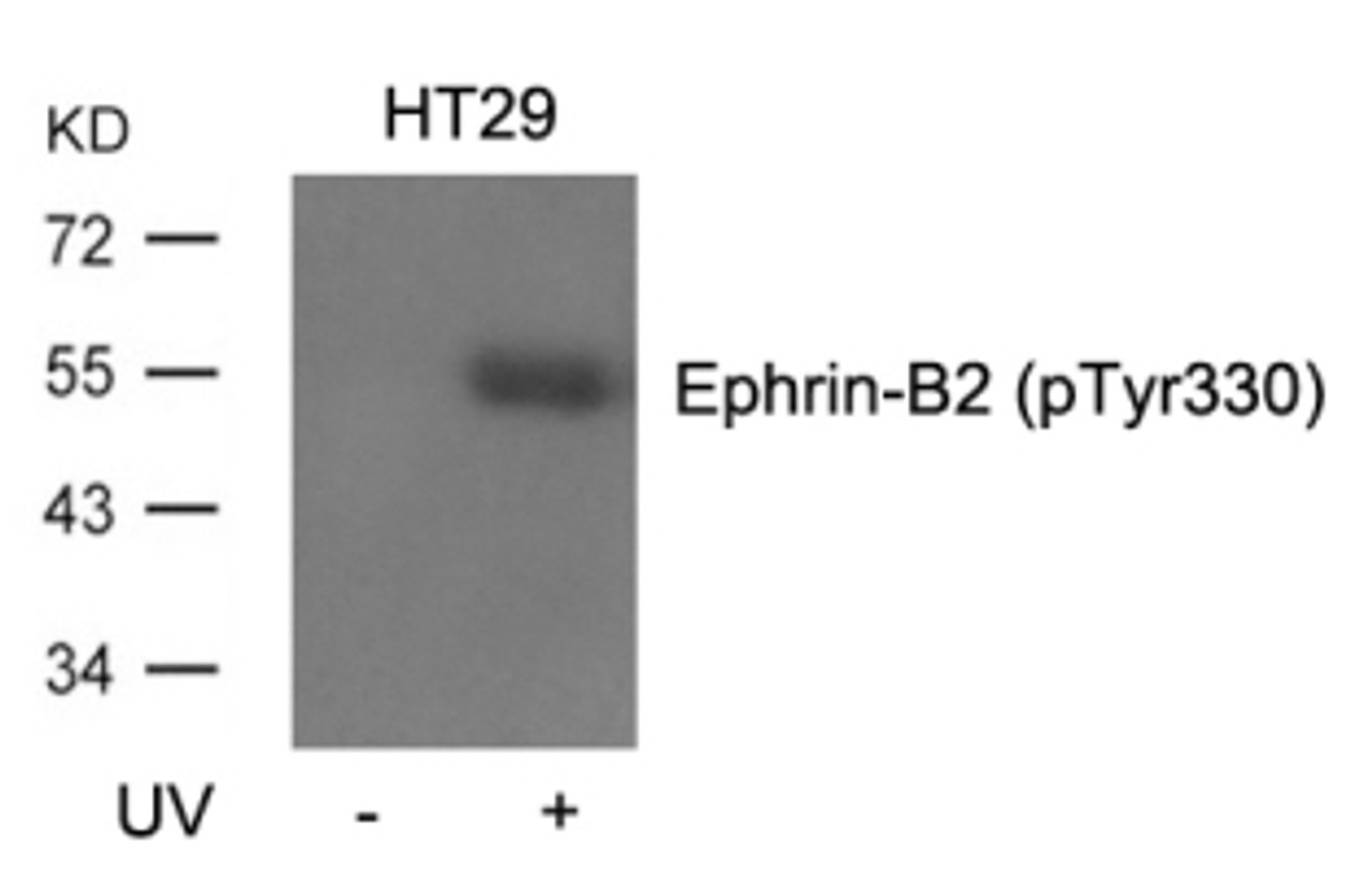 Western blot analysis of lysed extracts from HT29 cells, untreated or treated with UV using Ephrin-B2 (Phospho-Tyr330) .