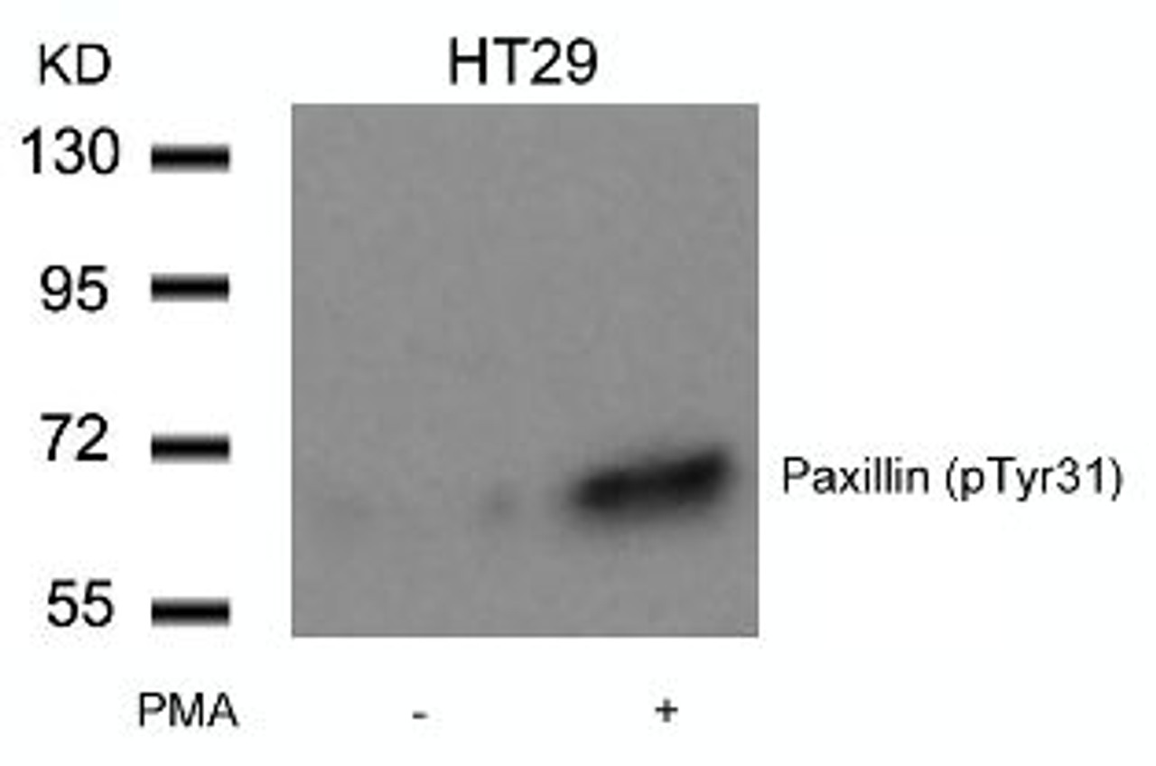 Western blot analysis of lysed extracts from HT29 cells untreated or treated with PMA using Paxillin (Phospho-Tyr31) .