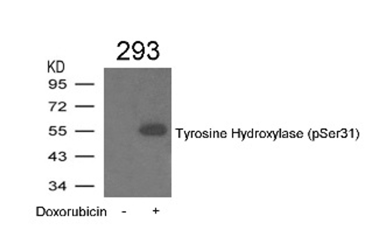 Western blot analysis of lysed extracts from 293 cells treated with Doxorubicin using Tyrosine Hydroxylase (Phospho-Ser31) .