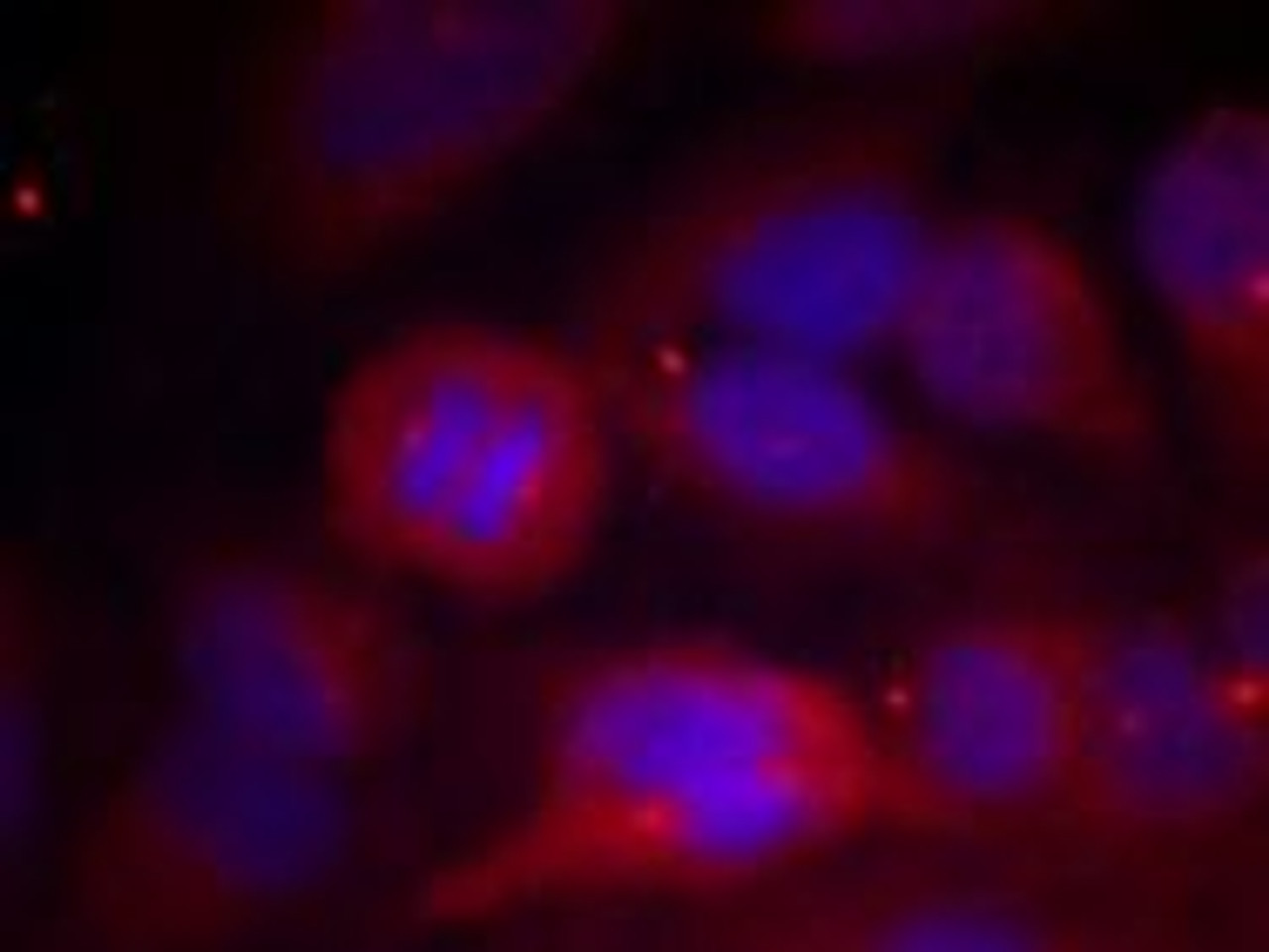 Immunofluorescence staining of methanol-fixed HeLa cells using Tyrosine Hydroxylase (Phospho-Ser40) .