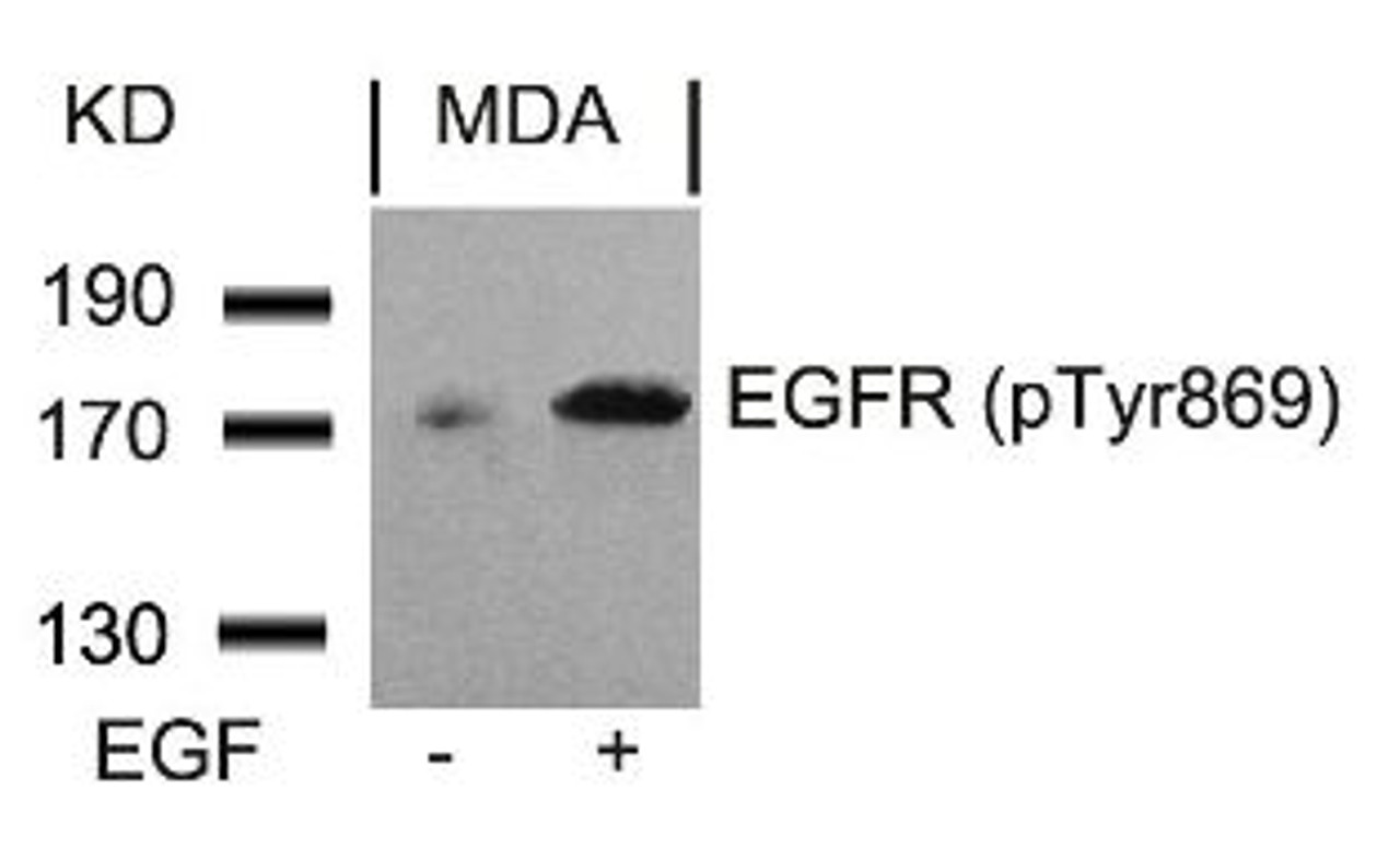 Western blot analysis of lysed extracts from MDA cells untreated or treated with EGF using EGFR (Phospho-Tyr869) .